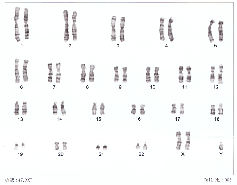 File:Zh-Human chromosomesXXY01.png